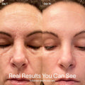 Solawave Beauty Device with Galvanic Current