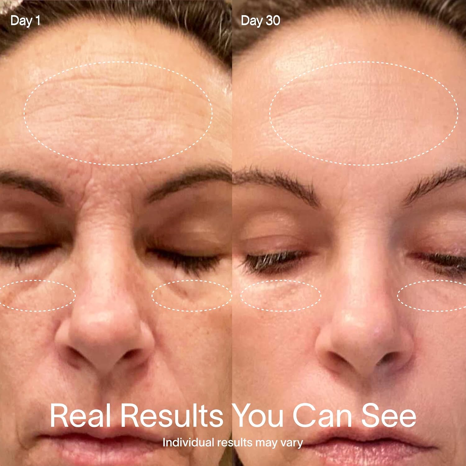 Solawave Beauty Device with Galvanic Current