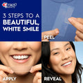Crest 3D Whitestrips Professional Effects Teeth Whitening Kit