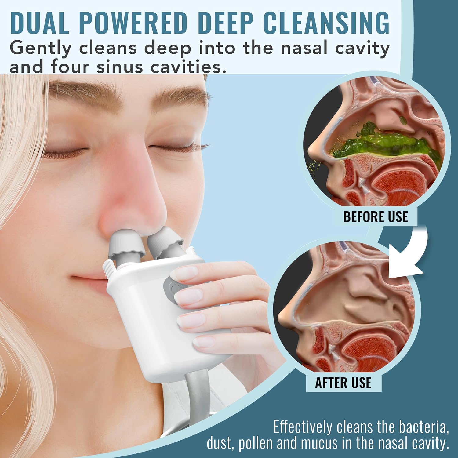NASALFRESH MD Dual Powered Nasal Irrigation System